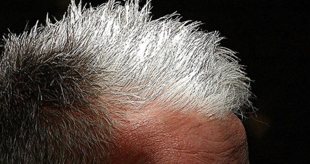 Beyaz saçı tarihe gömen sebze! Hem kökü koruyor hem beyazı önlüyor